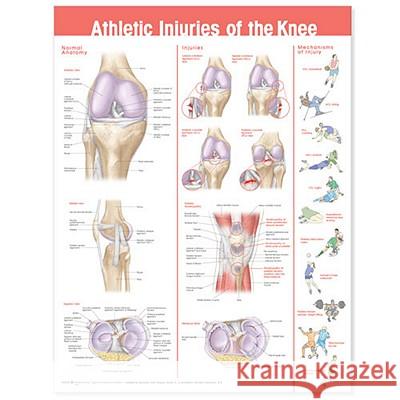 Athletic Injuries of the Knee Anatomical Chart  Anatomical Chart Company 9780781786720 0