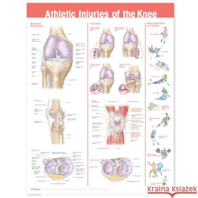 Athletic Injuries of the Knee Anatomical Chart  Anatomical Chart Company 9780781786751 0