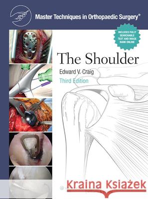 Master Techniques in Orthopaedic Surgery: Shoulder Edward Craig 9780781797481 LIPPINCOTT WILLIAMS & WILKINS
