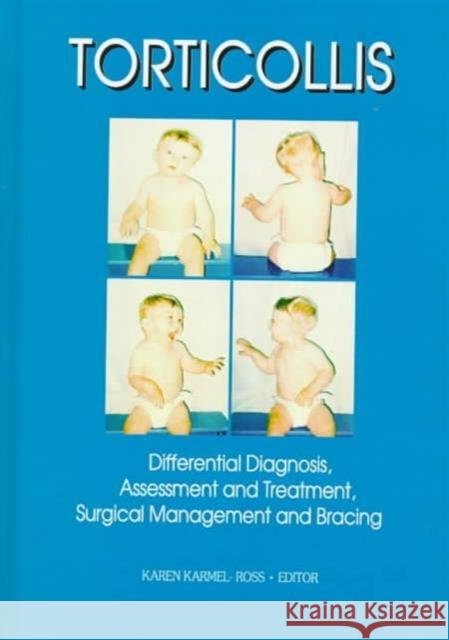 Torticollis : Differential Diagnosis, Assessment and Treatment, Surgical Management and Bracing Karen Karmel-Ross Karmel-Ross 9780789003164 Haworth Press