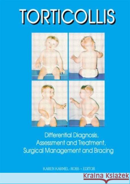 Torticollis: Differential Diagnosis, Assessment and Treatment, Surgical Management and Bracing Karmel-Ross, Karen 9780789003171 Haworth Press