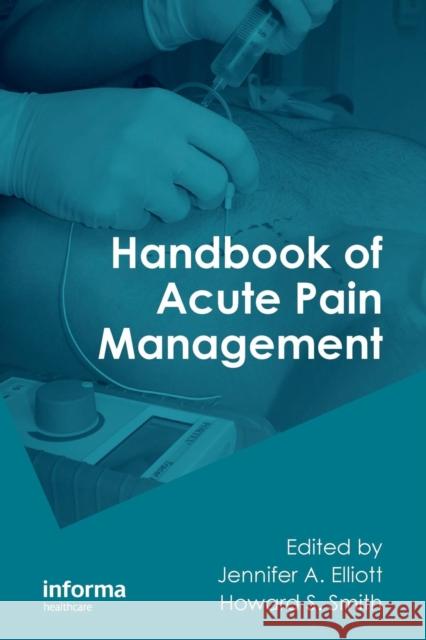 Handbook of Acute Pain Management Howard S. Smith Jennifer A. Elliott 9780789031686