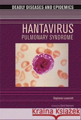 Hantavirus Pulmonary Syndrome Stephanie Leuenroth I. Edward Alcamo 9780791086766 Chelsea House Publications