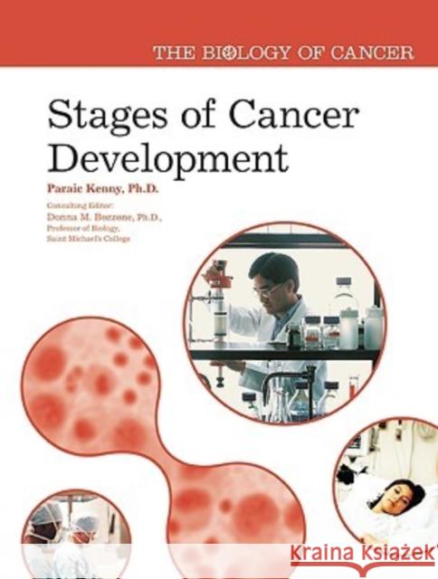 Stages of Cancer Development Paraic Kenny 9780791088258 Chelsea House Publications