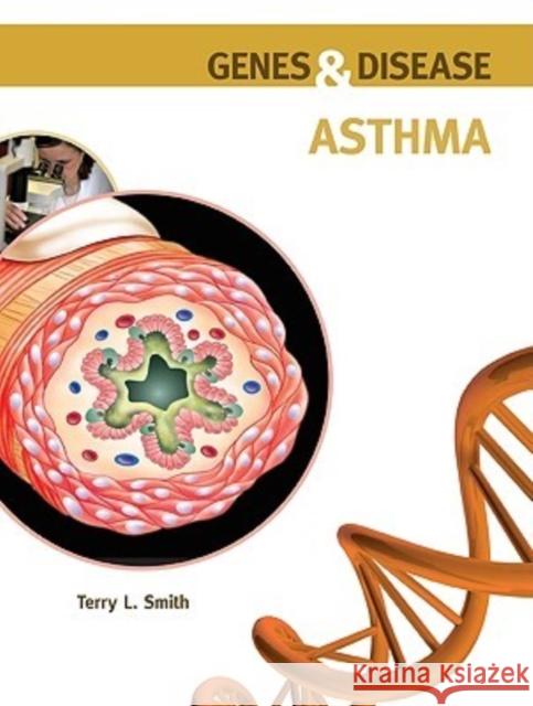 Asthma Terry L Smith 9780791096635 Chelsea House Publishers