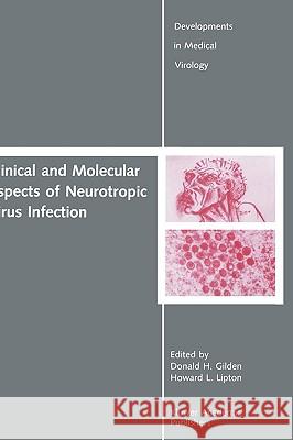 Clinical and Molecular Aspects of Neurotropic Virus Infection Donald H. Gilden Howard L. Lipton 9780792300274 Kluwer Academic Publishers