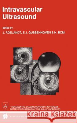 Intravascular Ultrasound T. Roelandt J. Roelandt Bom J. R. Roelandt 9780792323013 Kluwer Academic Publishers