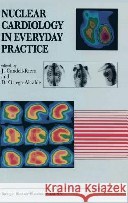 Nuclear Cardiology in Everyday Practice J. Candell-Riera J. Ed. Candell-Riera J. Candell-Riera 9780792323747 Springer Netherlands