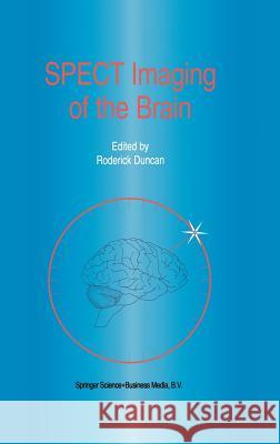 Spect Imaging of the Brain Duncan, R. 9780792341864 Springer Netherlands