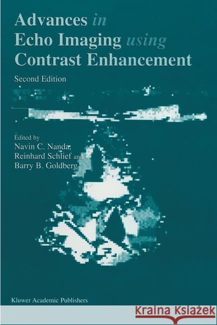 Advances in Echo Imaging Using Contrast Enhancement Navin C. Nanda Reinhard Schlief Barry Goldberg 9780792343554 Kluwer Academic Publishers