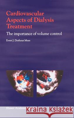 Cardiovascular Aspects of Dialysis Treatment: The Importance of Volume Control Dorhout Mees, E. J. 9780792362678 Kluwer Academic Publishers