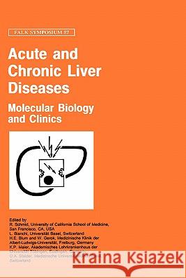 Acute and Chronic Liver Diseases: Molecular Biology and Clinics Schmid, R. 9780792387015 Kluwer Academic Publishers