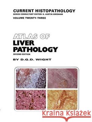 Atlas of Liver Pathology D. G. D. Wight 9780792388197 Kluwer Academic Publishers