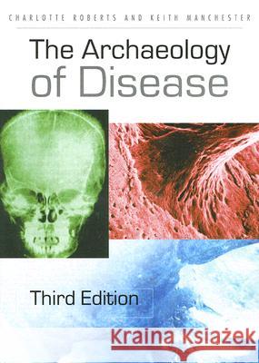 The Archaeology of Disease Charlotte Roberts Keith Manchester 9780801473883 Cornell University Press