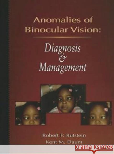 Anomalies of Binocular Vision: Diagnosis and Management Rutstein, Robert P. 9780801669163