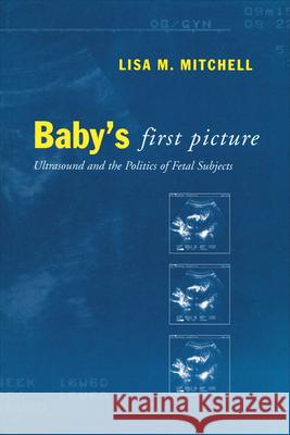 Baby's First Picture: Ultrasound and the Politics of Fetal Subjects Mitchell, Lisa M. 9780802083494 University of Toronto Press