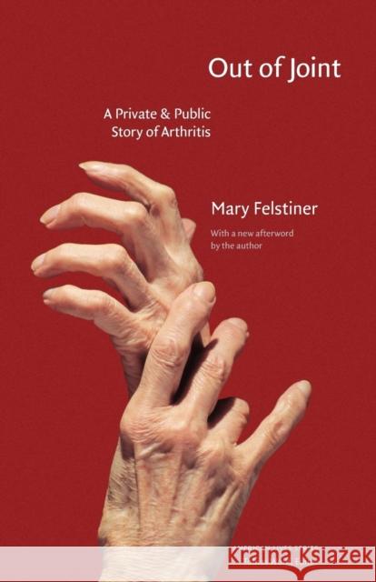 Out of Joint : A Private and Public Story of Arthritis Mary Lowenthal Felstiner 9780803260290 