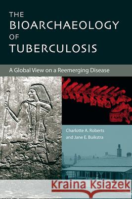 The Bioarchaeology of Tuberculosis: A Global View on a Reemerging Disease Roberts, Charlotte 9780813032696