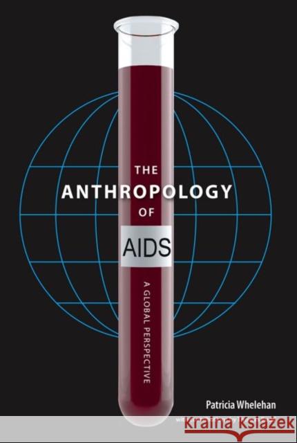 The Anthropology of AIDS: A Global Perspective Whelehan, Patricia 9780813056494 University Press of Florida