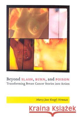 Beyond Slash, Burn, and Poison: Transforming Breast Cancer Stories into Action Knopf-Newman, Marcy 9780813534718 Rutgers University Press