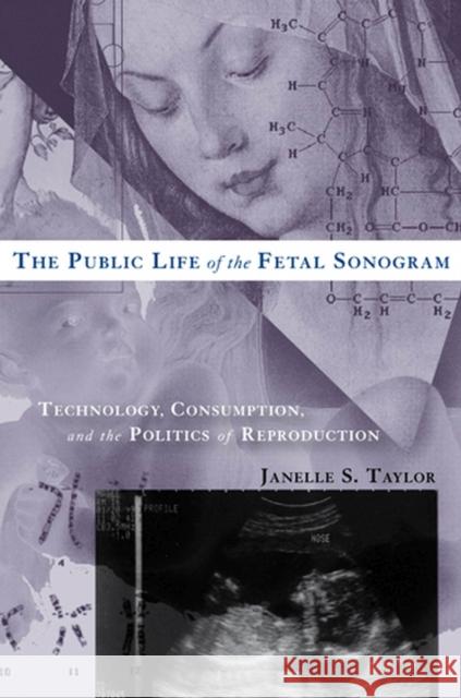 The Public Life of the Fetal Sonogram: Technology, Consumption, and the Politics of Reproduction Taylor, Janelle S. 9780813543642 Rutgers University Press