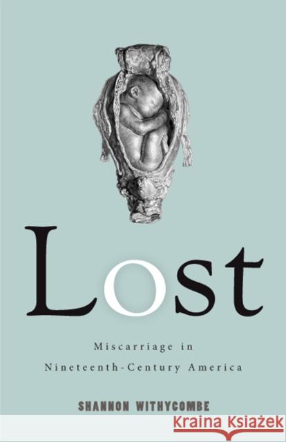 Lost: Miscarriage in Nineteenth-Century America Shannon Withycombe 9780813591537 Rutgers University Press