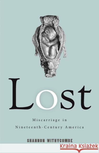 Lost: Miscarriage in Nineteenth-Century America Shannon Withycombe 9780813591544 Rutgers University Press