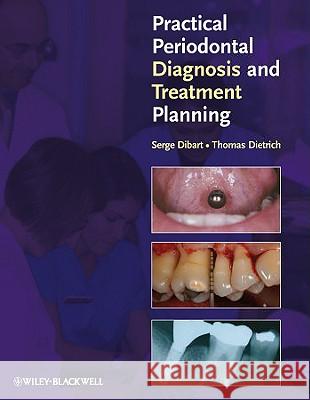 Practical Periodontal Diagnosis and Treatment Planning Serge Dibart Thomas Dietrich 9780813811840 Wiley-Blackwell