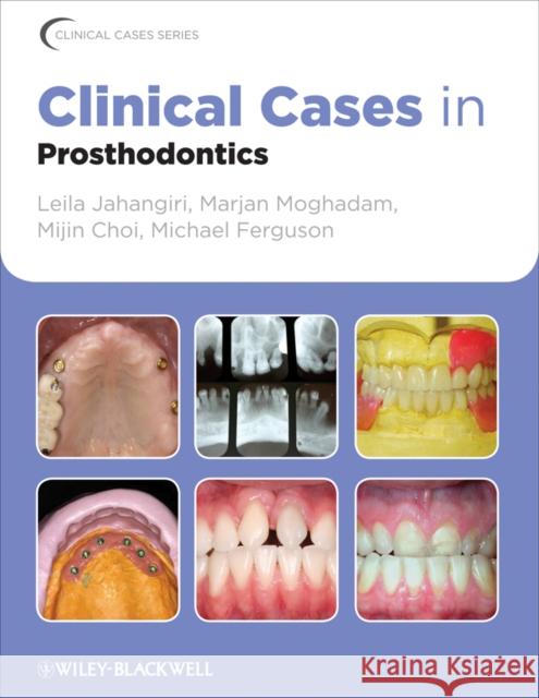Clinical Cases in Prosthodontics Leila Jahangiri Marjan Moghadam Mijin Choi 9780813816647 