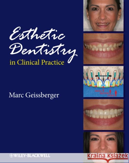 Esthetic Dentistry in Clinical Practice Marc Geissberger Geissberger 9780813828251 Wiley-Blackwell