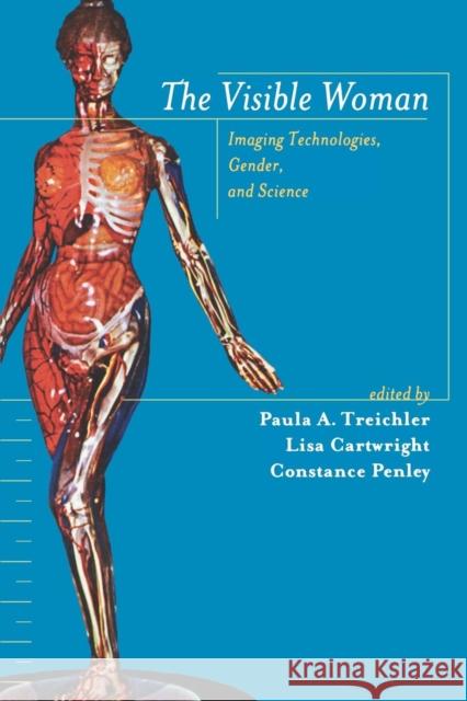 The Visible Woman: Imaging Technologies, Gender, and Science Treichler, Paula 9780814715567 New York University Press