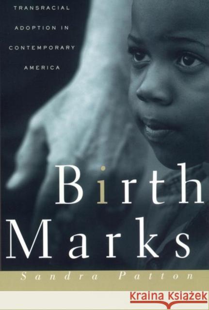Birthmarks: Transracial Adoption in Contemporary America Sandra Patton 9780814766811 New York University Press