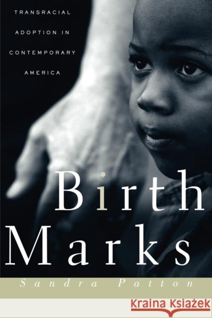 Birthmarks: Transracial Adoption in Contemporary America Sandra Patton 9780814766828 New York University Press
