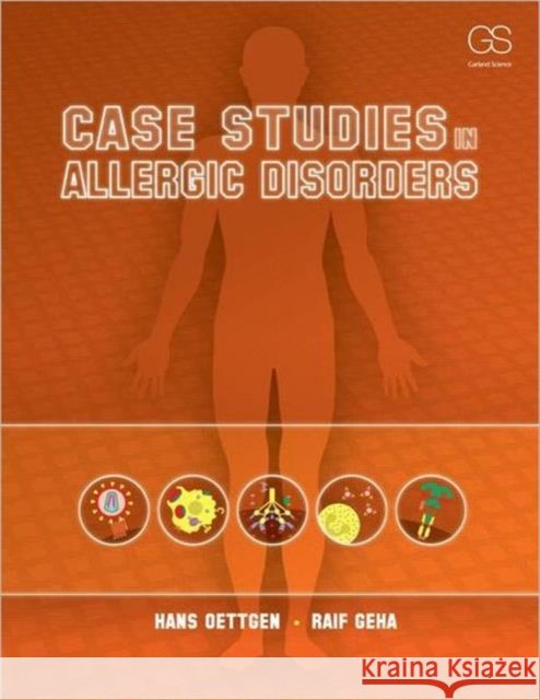 Case Studies in Allergic Disorders Hans Oettgen 9780815344360