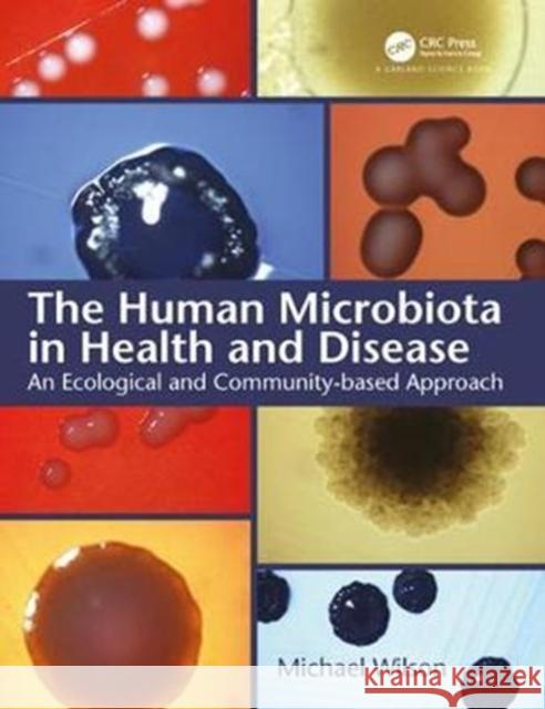 The Human Microbiota in Health and Disease: An Ecological and Community-Based Approach Mike Wilson 9780815345855 Garland Science