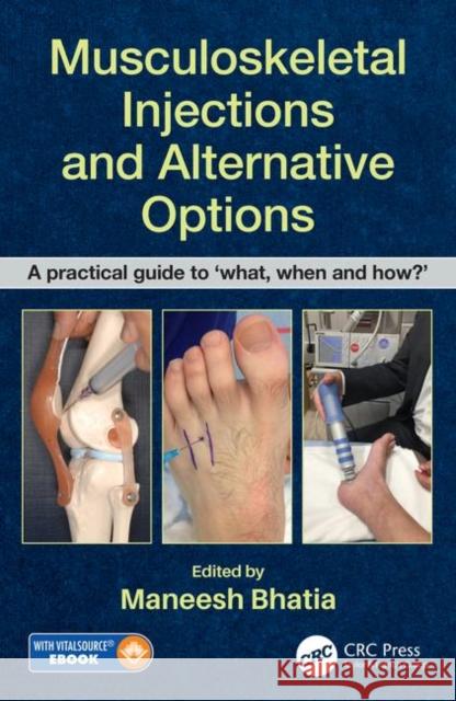 Musculoskeletal Injections and Alternative Options: A Practical Guide to 'What, When and How?' [With eBook] Bhatia, Maneesh 9780815355540 CRC Press