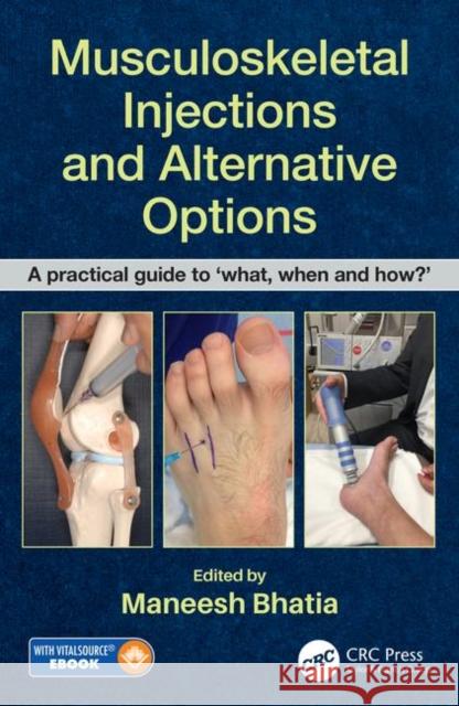 Musculoskeletal Injections and Alternative Options: A Practical Guide to 'What, When and How?' Bhatia, Maneesh 9780815355571