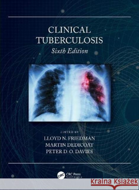 Clinical Tuberculosis Lloyd N. Friedman Martin Dedicoat Peter D. O. Davies 9780815370239