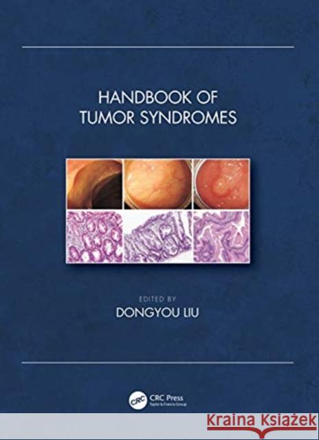 Handbook of Tumor Syndromes Dongyou Liu 9780815393801 CRC Press