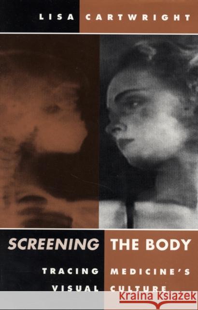 Screening the Body: Tracing Medicine's Visual Culture Cartwright, Lisa 9780816622900