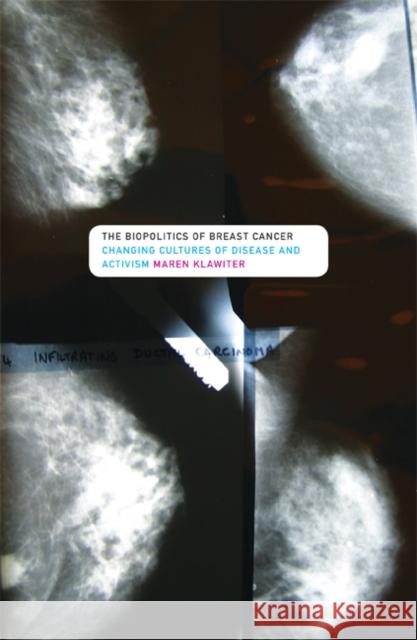 The Biopolitics of Breast Cancer: Changing Cultures of Disease and Activism Klawiter, Maren 9780816651085 University of Minnesota Press