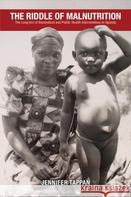The Riddle of Malnutrition: The Long Arc of Biomedical and Public Health Interventions in Uganda Jennifer Tappan 9780821422458 Ohio University Press