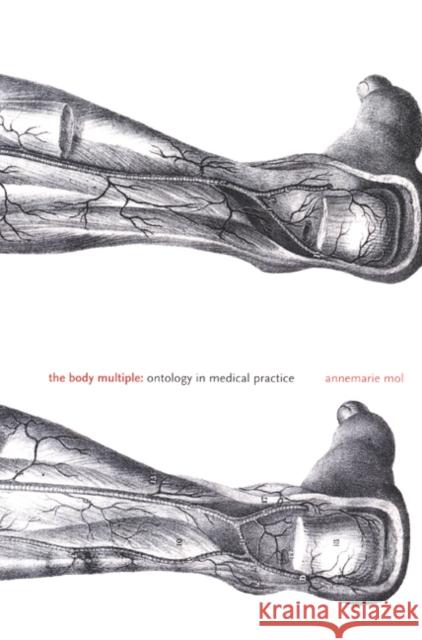 The Body Multiple: Ontology in Medical Practice Mol, Annemarie 9780822329022 Duke University Press