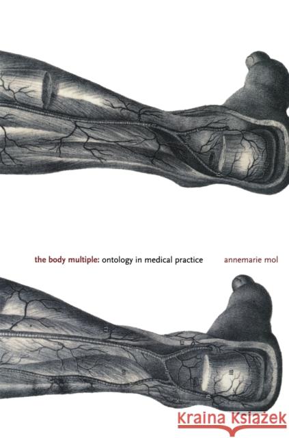 The Body Multiple: Ontology in Medical Practice Annemarie Mol 9780822329176 Duke University Press