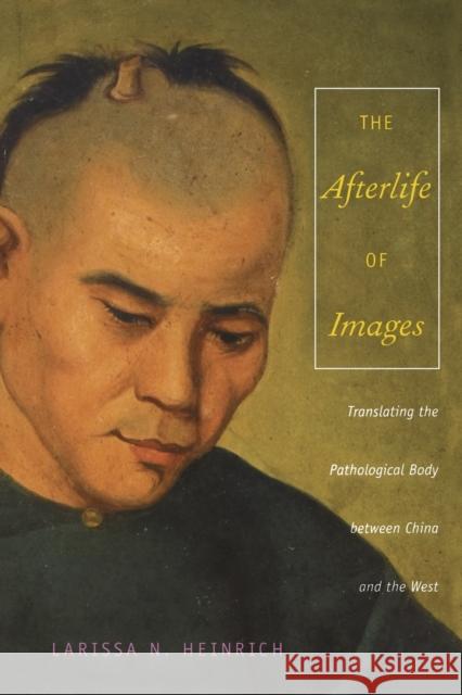 The Afterlife of Images: Translating the Pathological Body between China and the West Heinrich, Ari Larissa 9780822341130