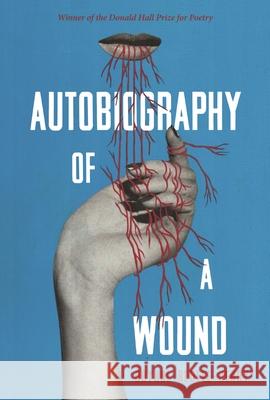 Autobiography of a Wound Brynne Rebele-Henry 9780822965671 University of Pittsburgh Press
