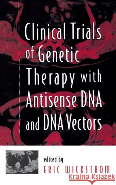Clinical Trials of Genetic Therapy with Antisense DNA and DNA Vectors Eric Wickstrom 9780824700850 Marcel Dekker