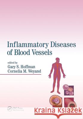 Inflammatory Diseases of Blood Vessels Gary S. Hoffman Cornelia M. Weyand Hoffman/Weyand 9780824702694