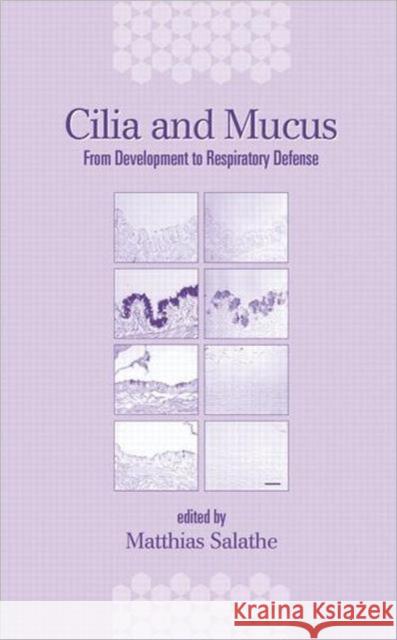 Cilia and Mucus: From Development to Respiratory Defense Matthias Salathe Salathe 9780824704414 CRC