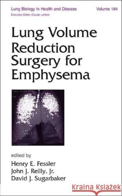Lung Volume Reduction Surgery for Emphysema Fessler E. Fessler Henry E. Fessler John J., JR. Reilly 9780824708979 Informa Healthcare